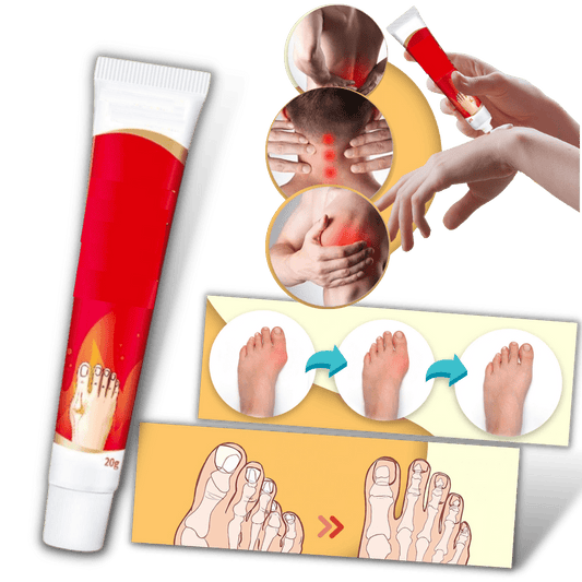 Beruhigende Creme zur Linderung von Fußzehenknorren