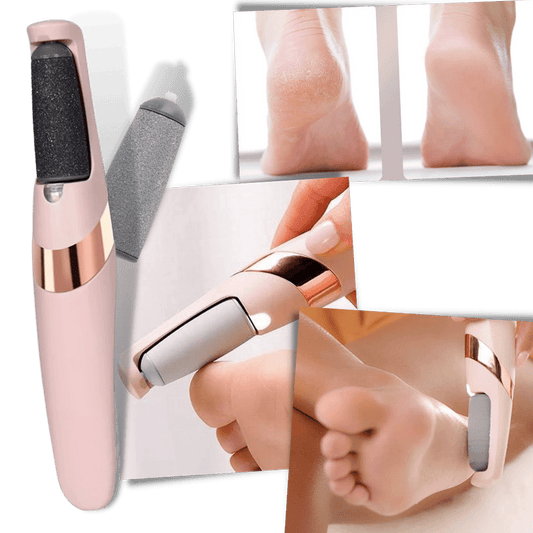Innovativer Elektrischer Epilierer zur Entfernung von Hornhaut