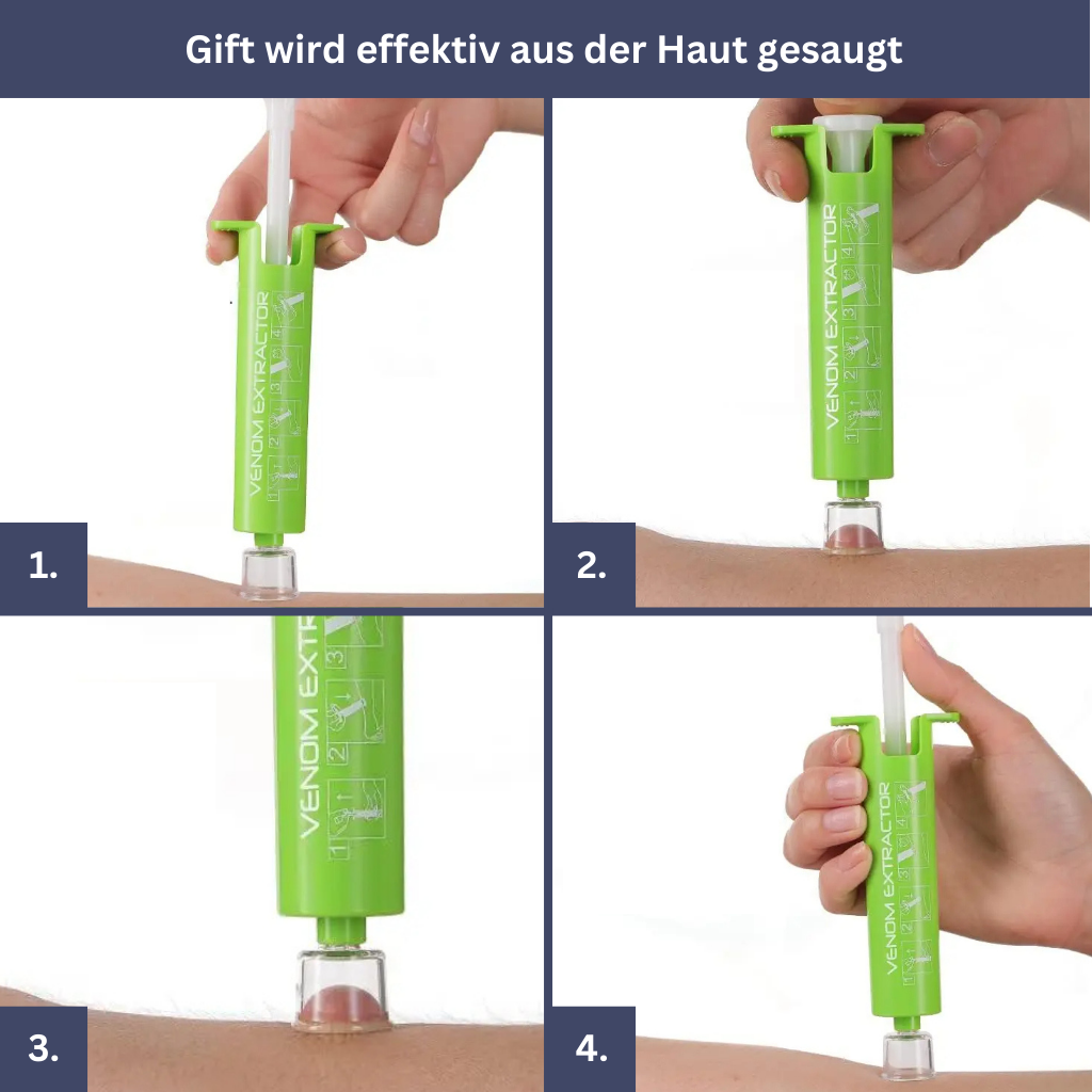 Ultimatives Insektenabwehr-Set - Juckreiz-Linderungsgerät, Stechapparat-Entferner, Mückenarmband