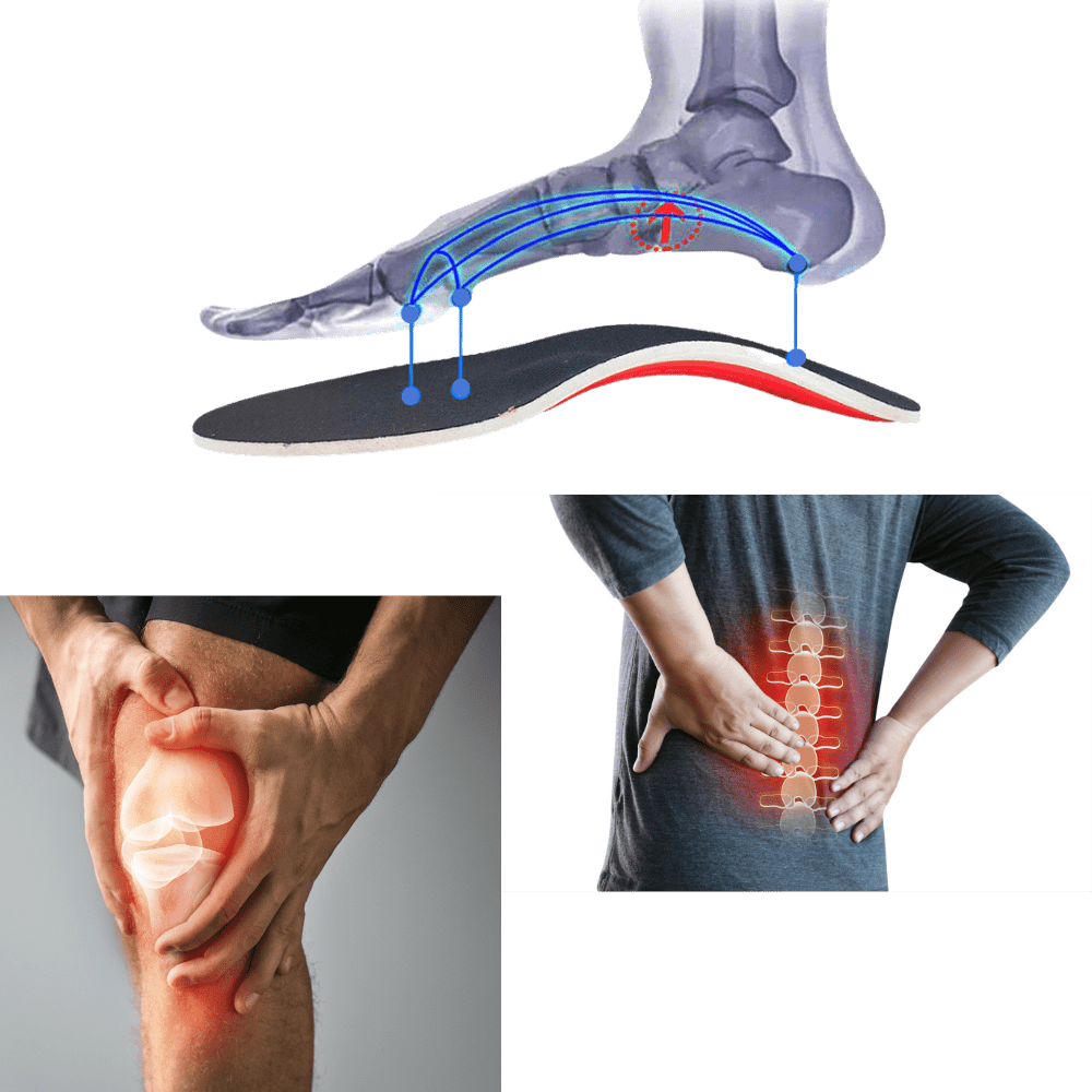 Optimale Komfort-Fest-Einlagen für Plattfüße - 1 Paar