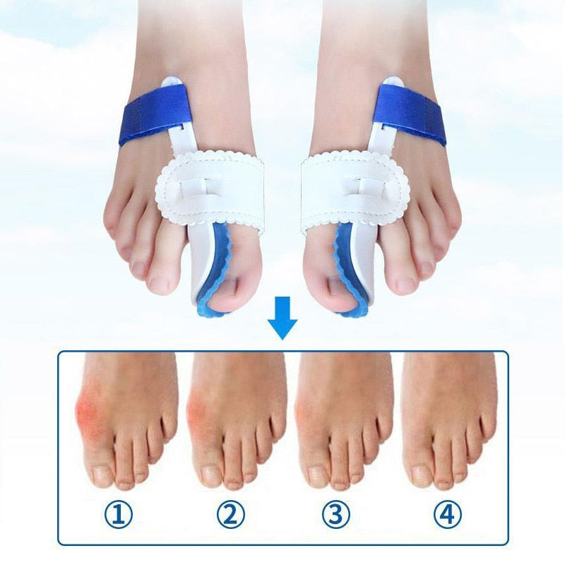 HarmonyStep Hallux Valgus Korrektor