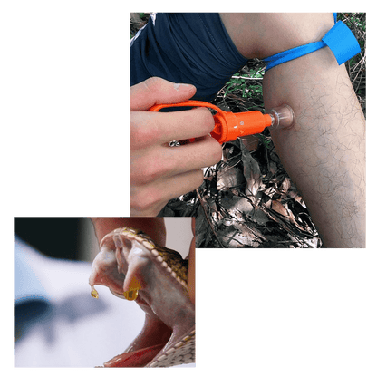 Notfallset zur Schlangengiftentfernung