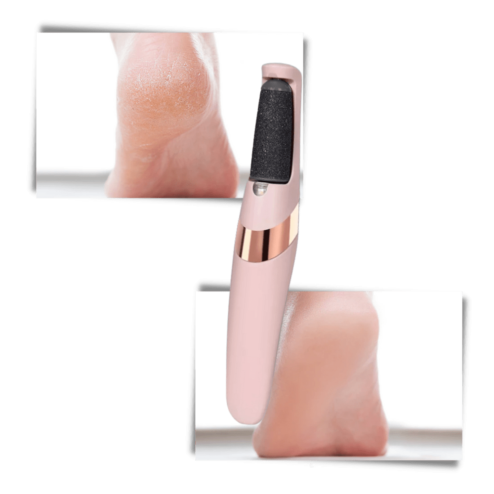 Innovativer Elektrischer Epilierer zur Entfernung von Hornhaut