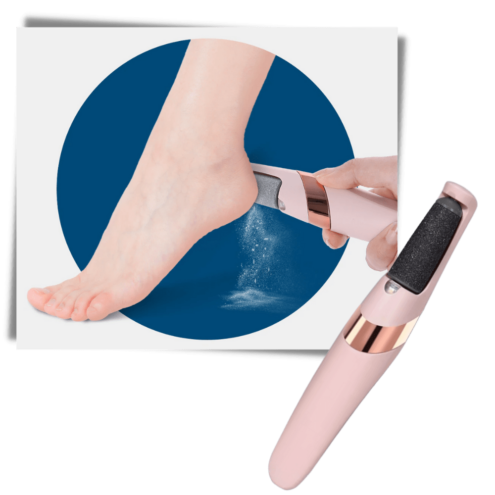 Innovativer Elektrischer Epilierer zur Entfernung von Hornhaut