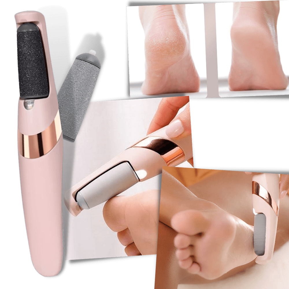 Innovativer Elektrischer Epilierer zur Entfernung von Hornhaut
