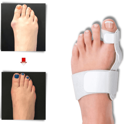 Orthopädischer Hallux Valgus Korrektor zur Schmerzlinderung