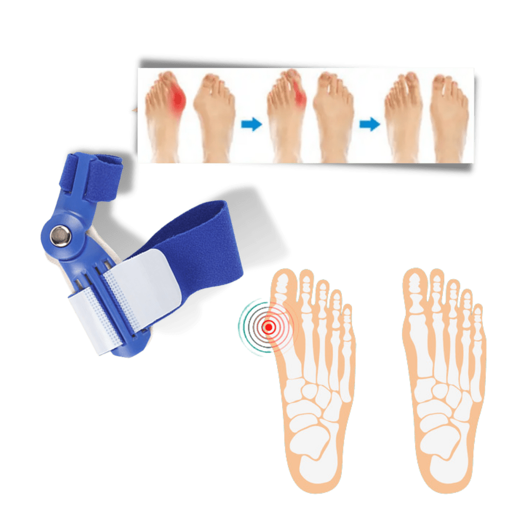 Orthopädischer Hallux Valgus Korrektor zur Schmerzlinderung