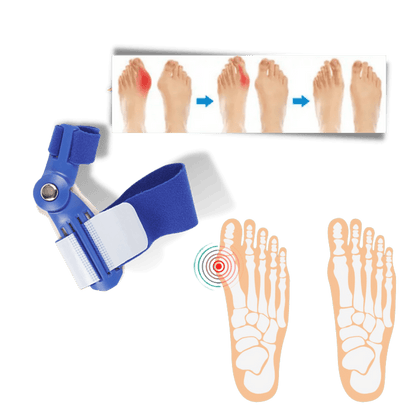 Orthopädischer Hallux Valgus Korrektor zur Schmerzlinderung