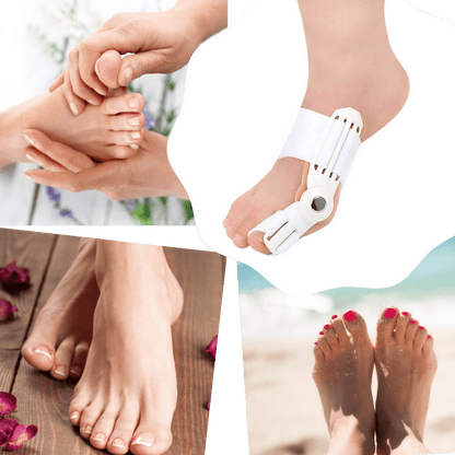 Orthopädischer Hallux Valgus Korrektor zur Schmerzlinderung
