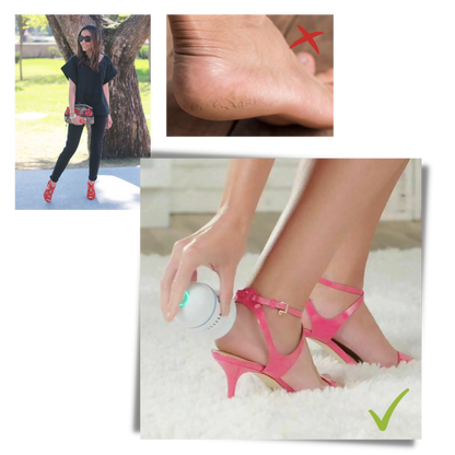 Elektrischer Epilierer für weiche und seidige Füße