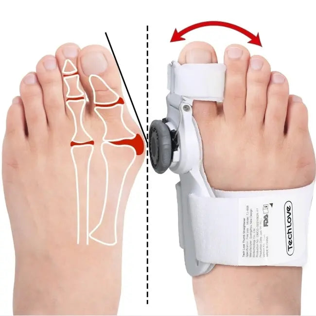 Hallux-Valgus-Korrektor, Bunion-Korrektorschiene