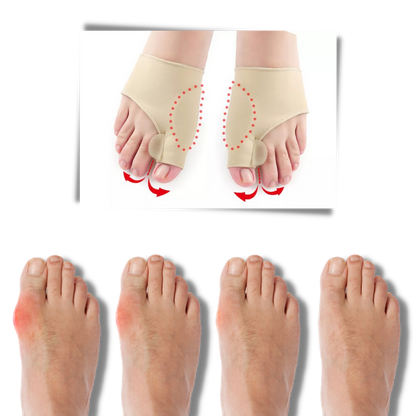 Reparierendes Gel für Hornhaut an den Füßen