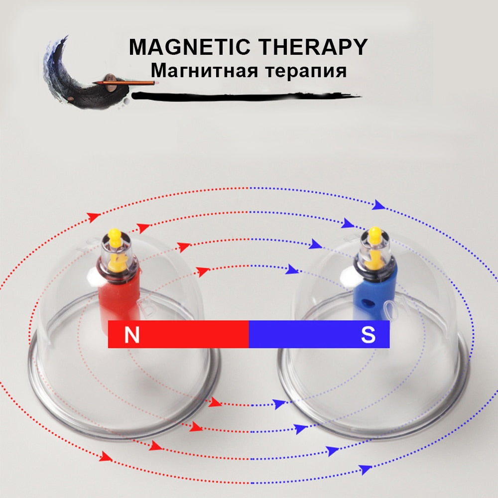 SCHRÖPFEN-Therapie-Set Chinesische Schröpfbecher