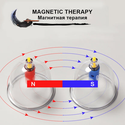 SCHRÖPFEN-Therapie-Set Chinesische Schröpfbecher