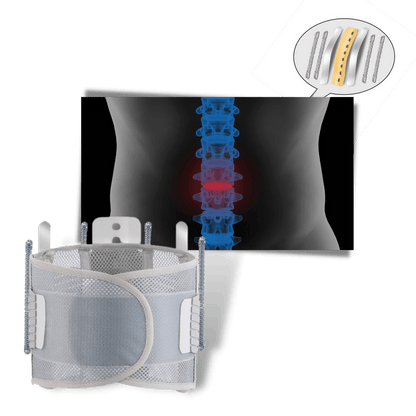 Orthopädischer Lendenwirbelstützgürtel für optimalen Komfort