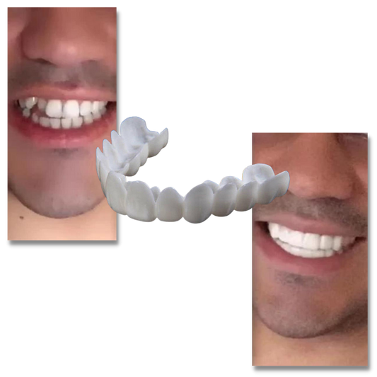 Perfektes Lächeln in Sekundenschnelle: Wiederverwendbarer, Schmerzfreier Zahnschutz