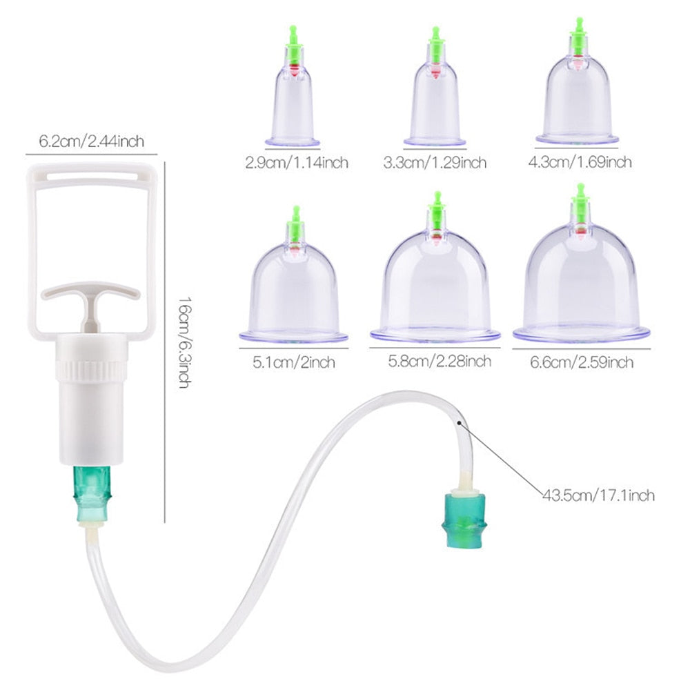 SCHRÖPFEN-Therapie-Set Chinesische Schröpfbecher