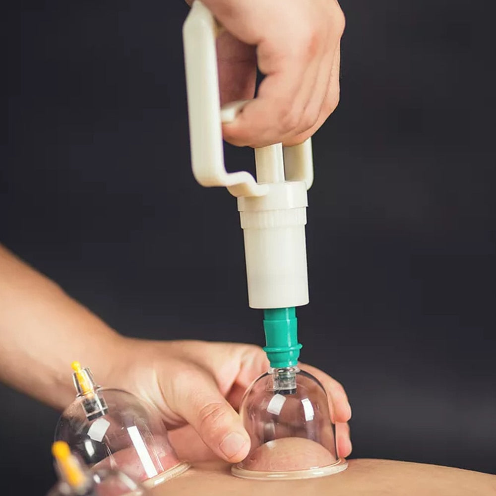 SCHRÖPFEN-Therapie-Set Chinesische Schröpfbecher