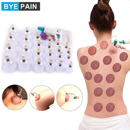 SCHRÖPFEN-Therapie-Set Chinesische Schröpfbecher