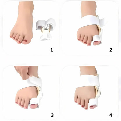 Orthopädische Schienen zur effektiven Korrektur von Hallux Valgus für komfortable Füße