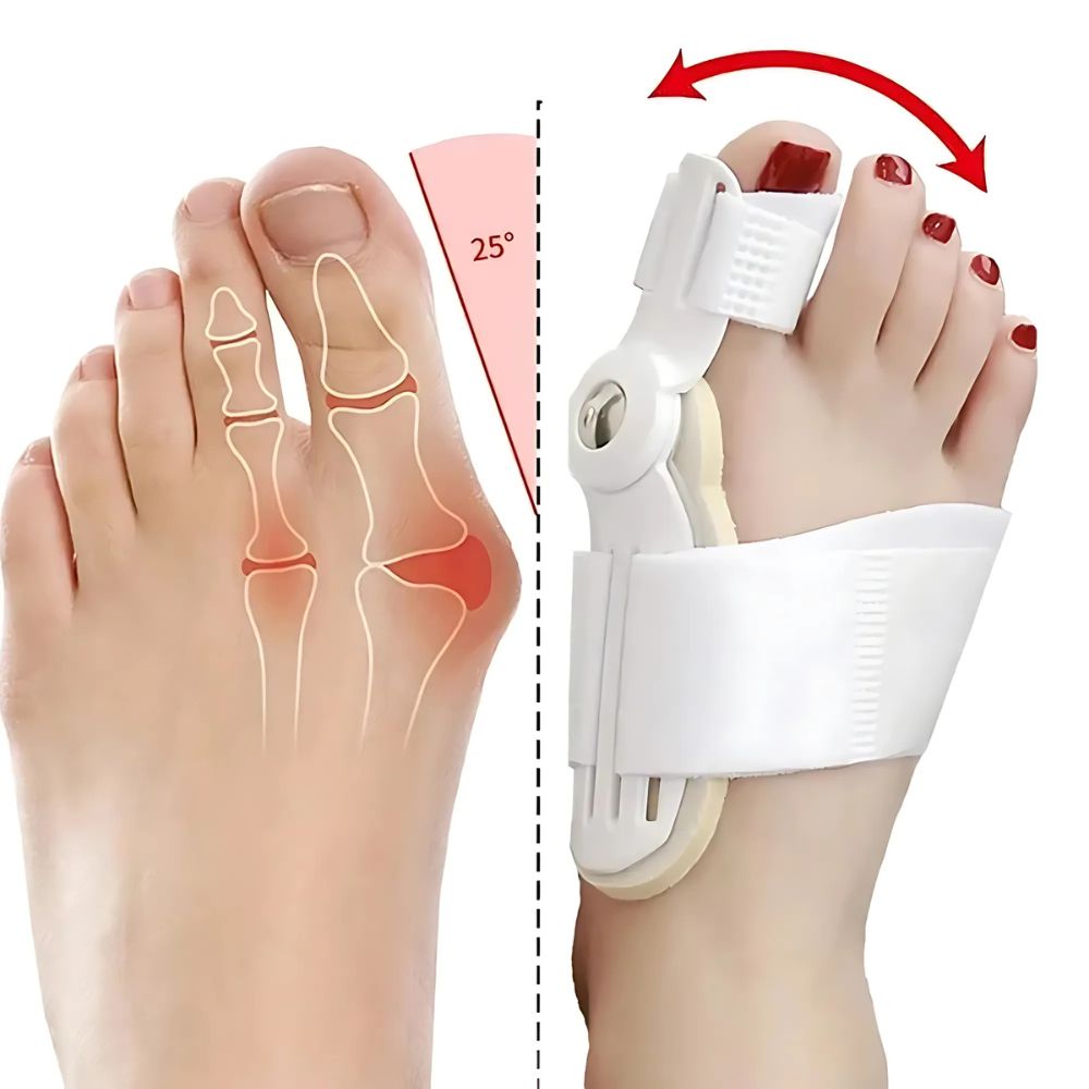 Orthopädische Schienen zur effektiven Korrektur von Hallux Valgus für komfortable Füße