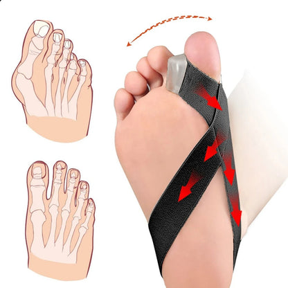 Hallux-Valgus-Korrektor – Komfort beim ersten Schritt