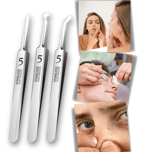 Präzisionspinzette zur Entfernung von Mitessern